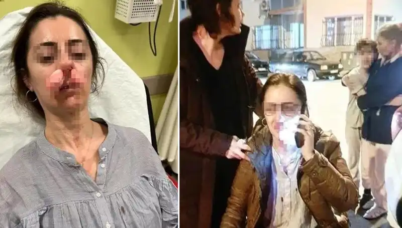 Eşinin Sevgilisi Sandığı Otomobil Kapısıyla Olay Yarattı!
