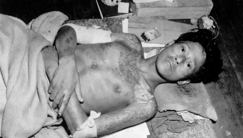 80 Yıl Sonra Nagasaki’den Gelen Korkutucu Çağrı: Nükleer Felaket Olabilir mi?