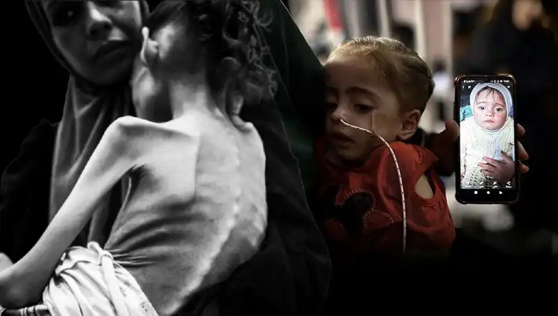 25 Kilodan 10 Kiloya Düşen Meryem'in Zorlu Açlık Mücadelesi